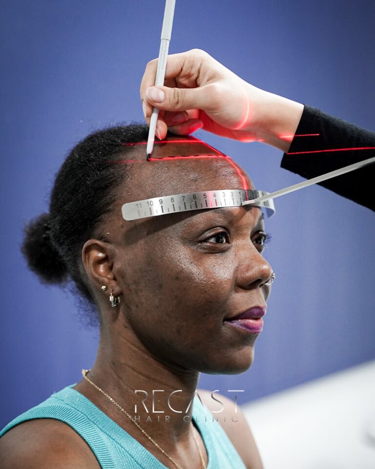 Digitale Haaranalyse