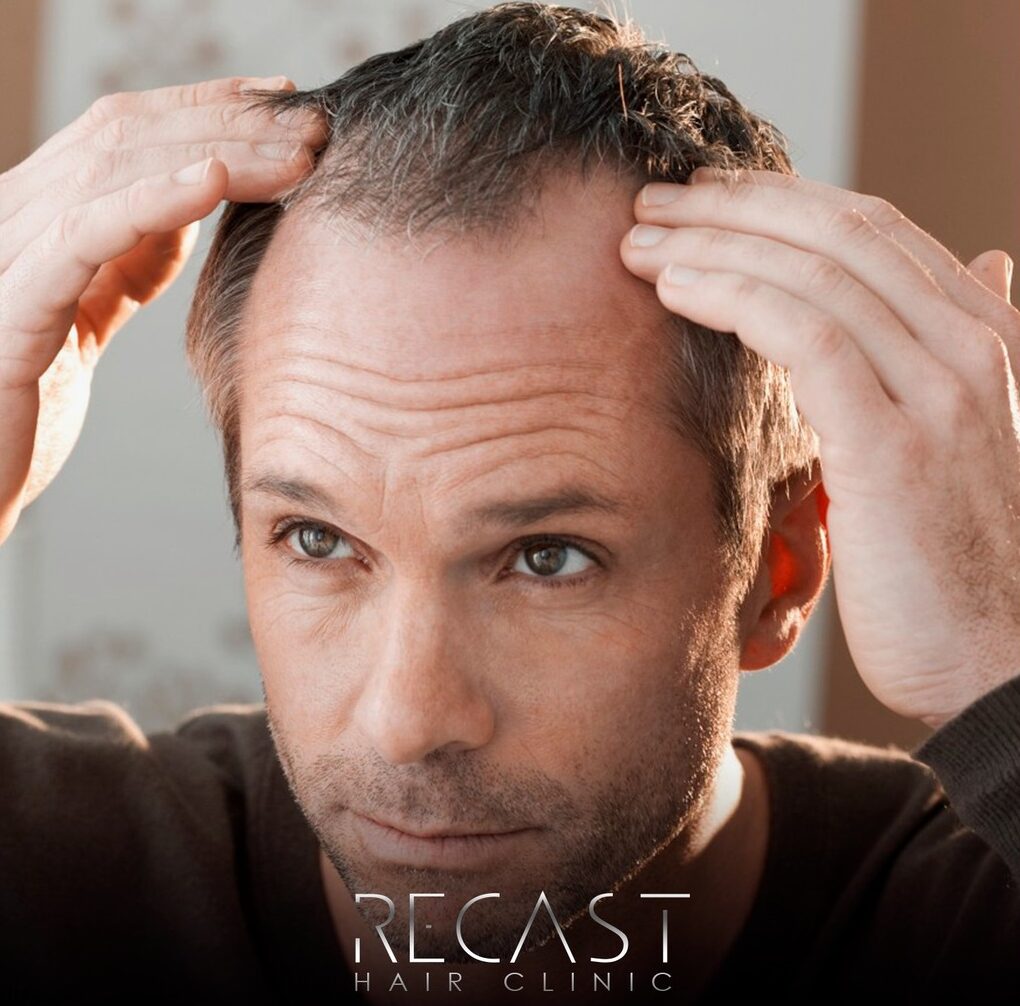 Mesotherapie für Haare