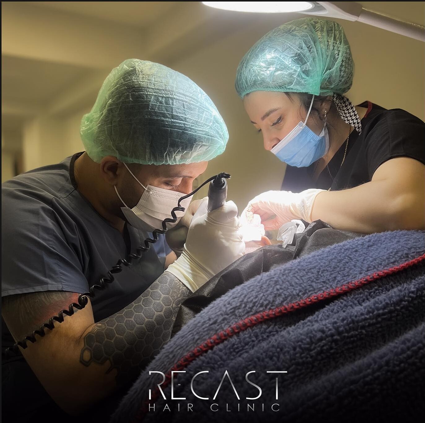 Schnurrbart Transplantation