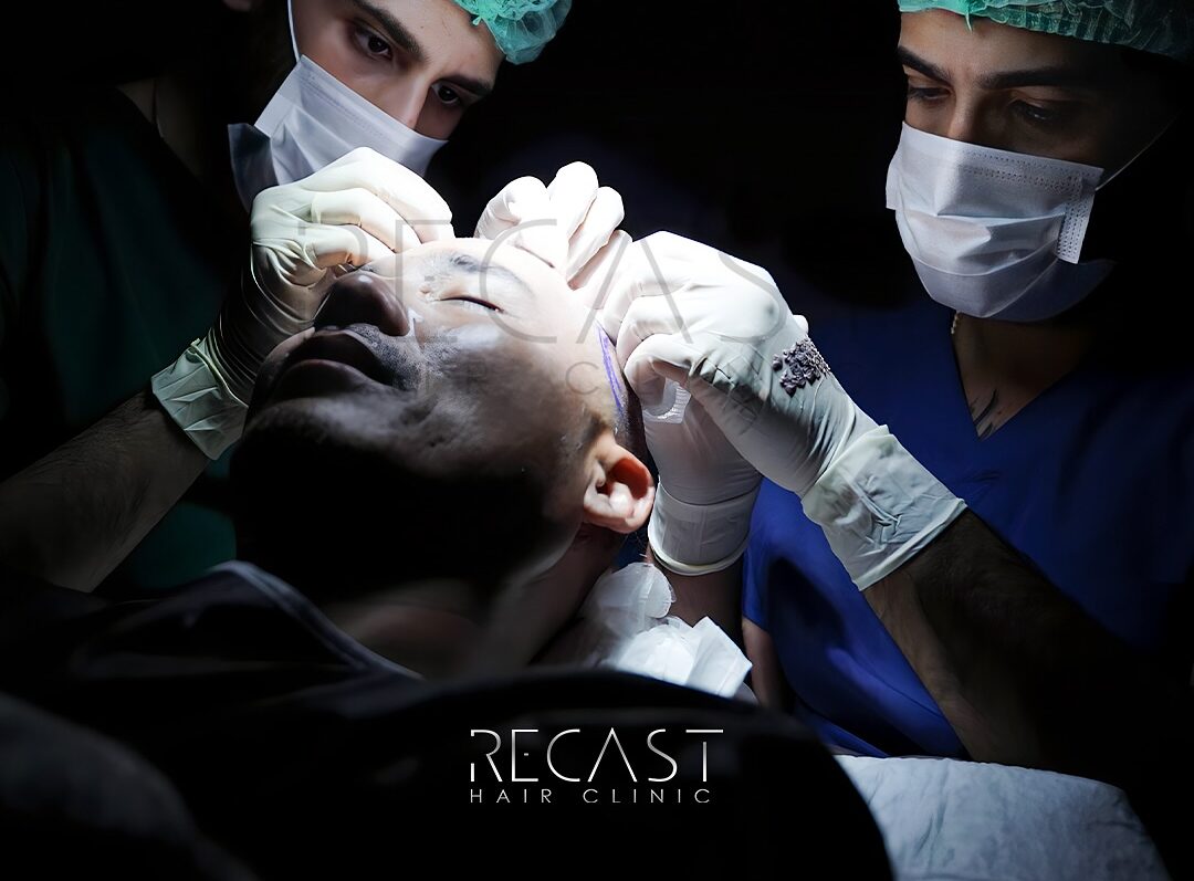 Haarklinik - Recast Hair Clinic Team